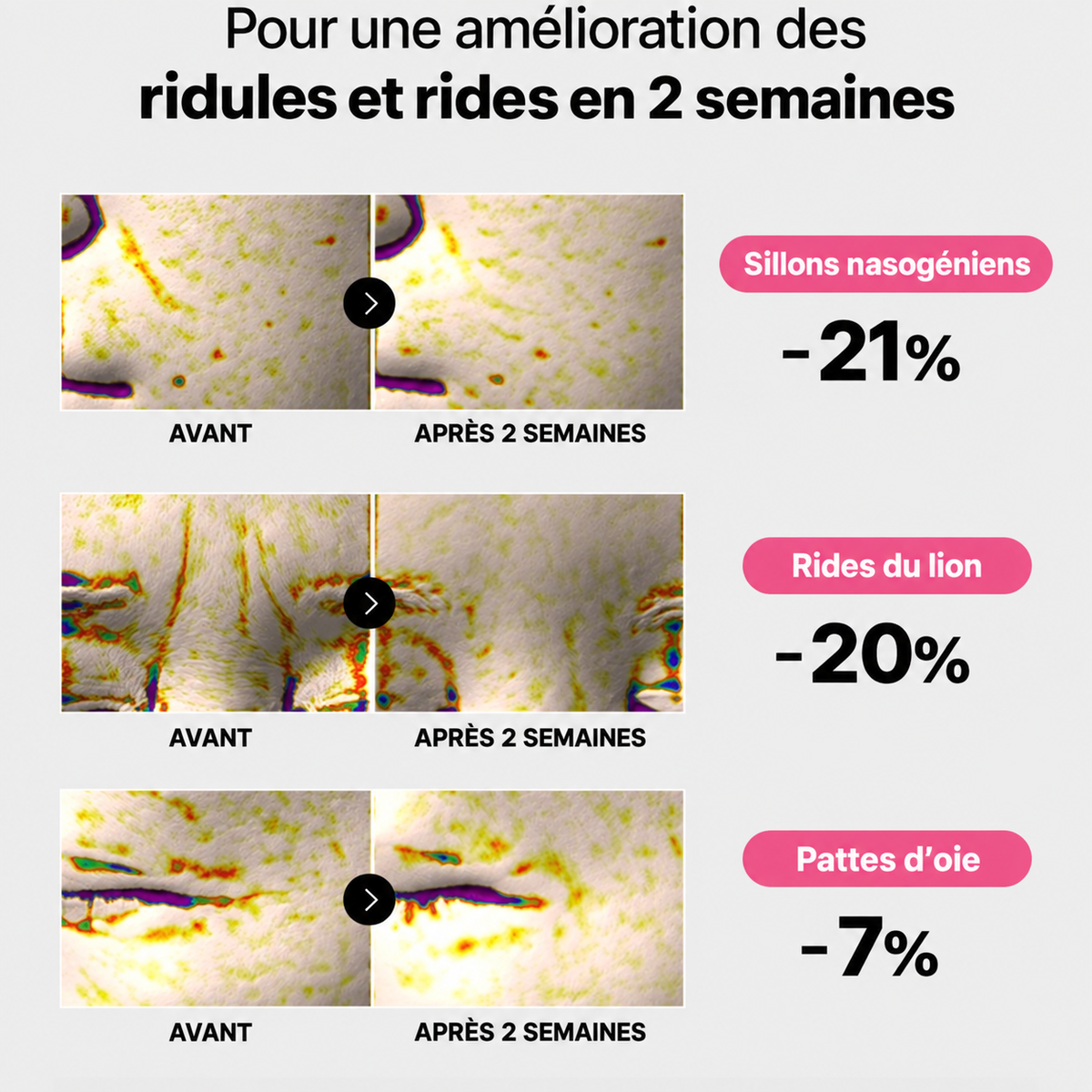 Patchs Hydrogel Anti-Cernes - Caféine, Collagène, Niacinamide