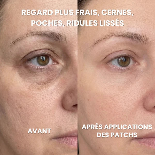 Patchs Hydrogel Anti-Cernes - Caféine, Collagène, Niacinamide